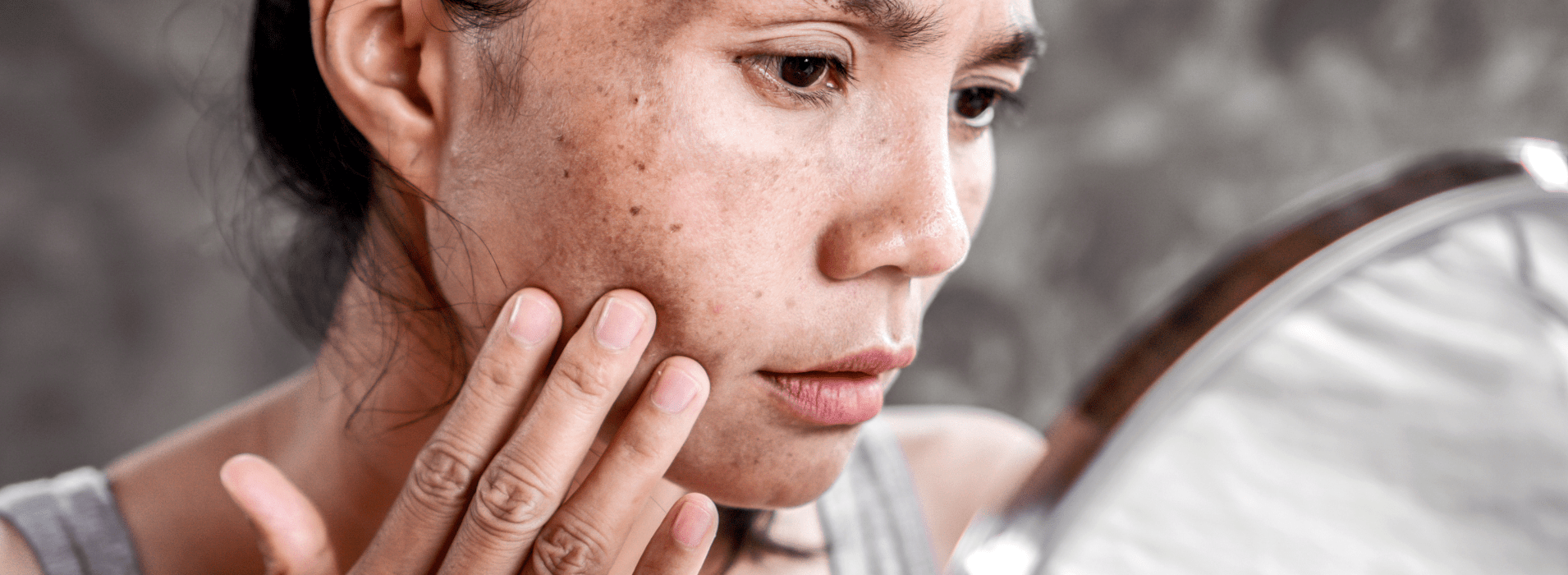 "La Polución y la Contaminación: ¿Cómo Afectan la Salud de Nuestra Piel?" - Badana