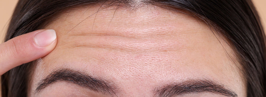 ¿Por qué te están saliendo arrugas antes de tiempo? No es la edad… son tus hábitos