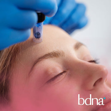 Microneedling para secuelas de Acné
